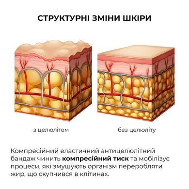 Kompleks modelujących okład&oacute;w antycellulitowych z ekstraktem z ashwagandhy Ashwagandha Hot Slim Hillary (10 opakowań)