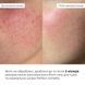 Comprehensive beauty set for dry and normal skin Perfect Centella Deep Hydration Hillary №2